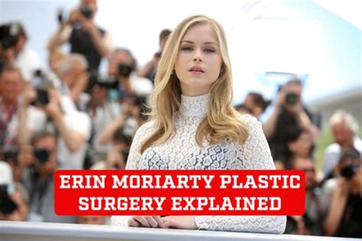Sarah Hyland's Plastic Surgery: Uncovering The Truth